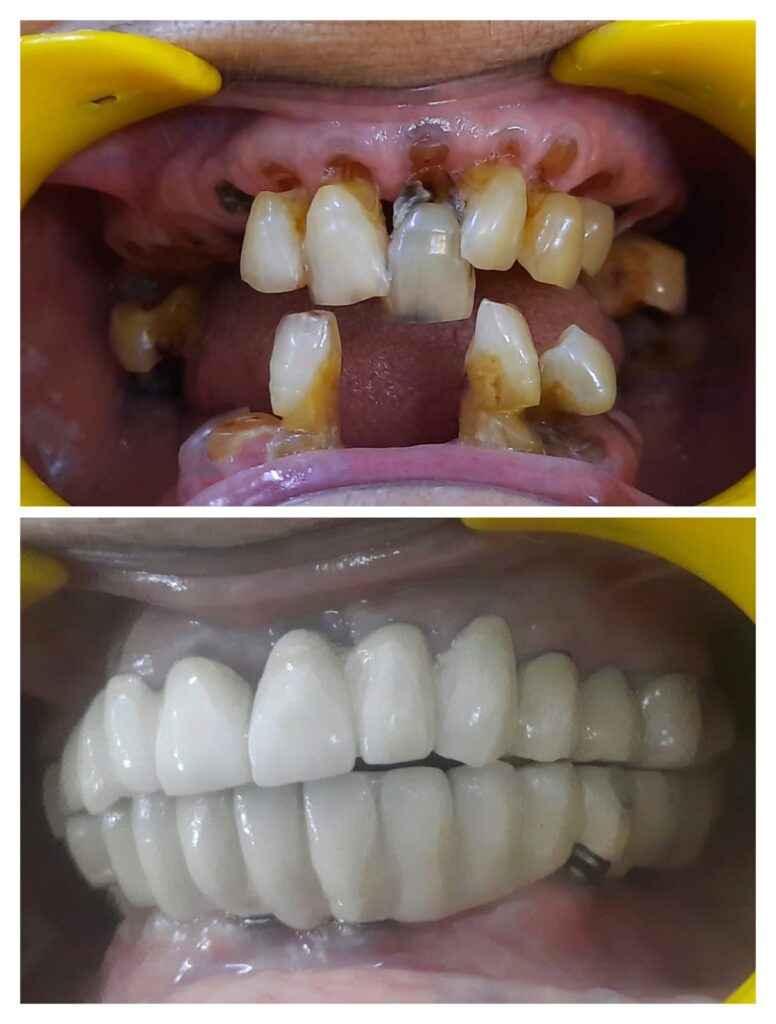 whatsapp image 2026 04 20 at 7.12.44 pm