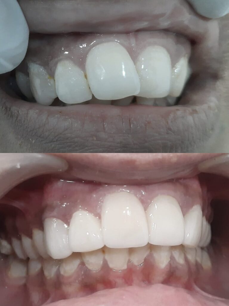 whatsapp image 2026 04 20 at 7.15.31 pm