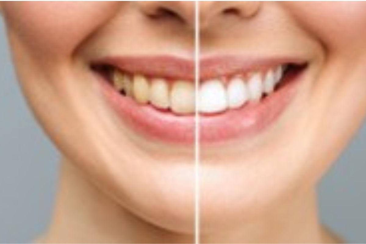 Cosmetic Dentistry<gwmw style="display:none;"></gwmw> untitled design (1)