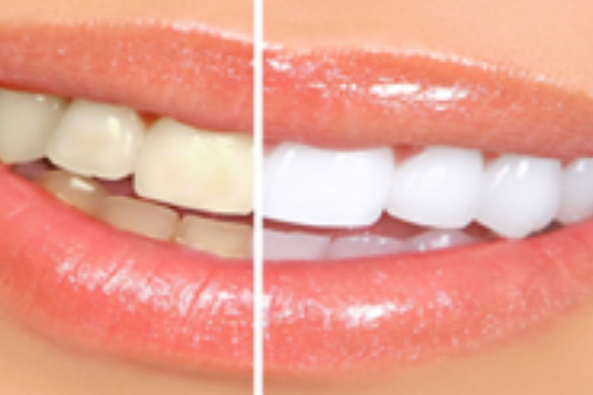Cosmetic Dentistry<gwmw style="display:none;"></gwmw> untitled design (4)