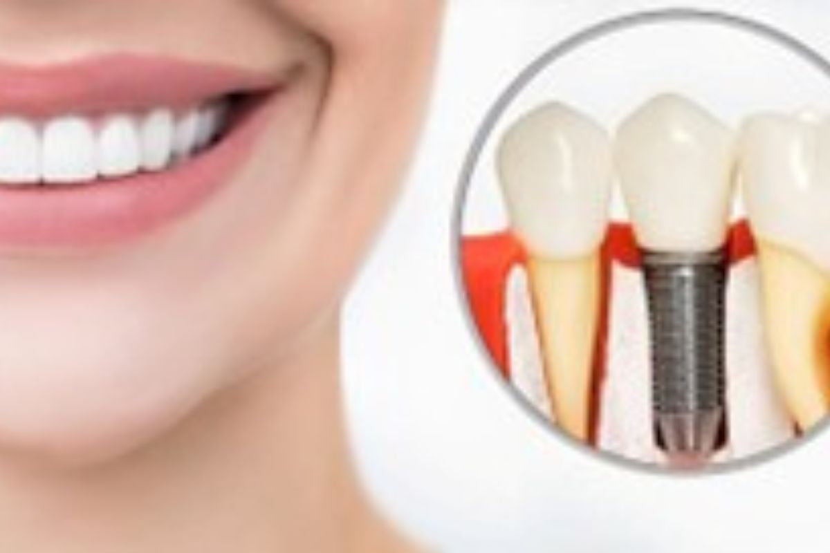 Cosmetic Dentistry<gwmw style="display:none;"></gwmw> yntitled design (3)